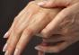 Коричневые пятна на коже рук: как избавиться от неприятных пятен Темнеет кожа на кистях рук